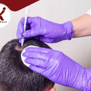 زراعة الشعر في السعودية 2023