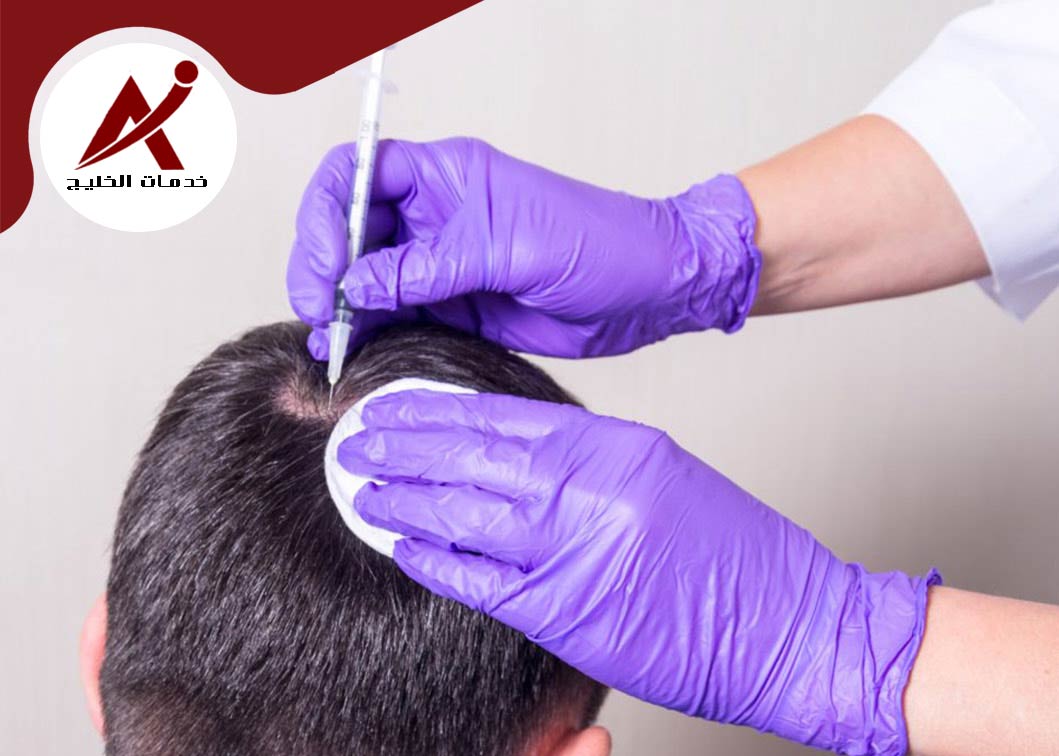 زراعة الشعر في السعودية 2023